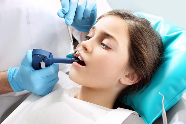 How Dental Sealants Protect Teeth From Decay